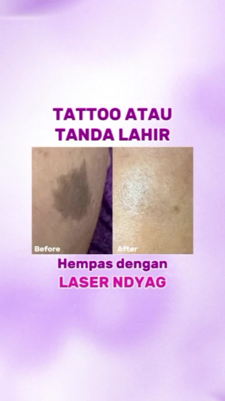 @Leny Skincare Karawaci
