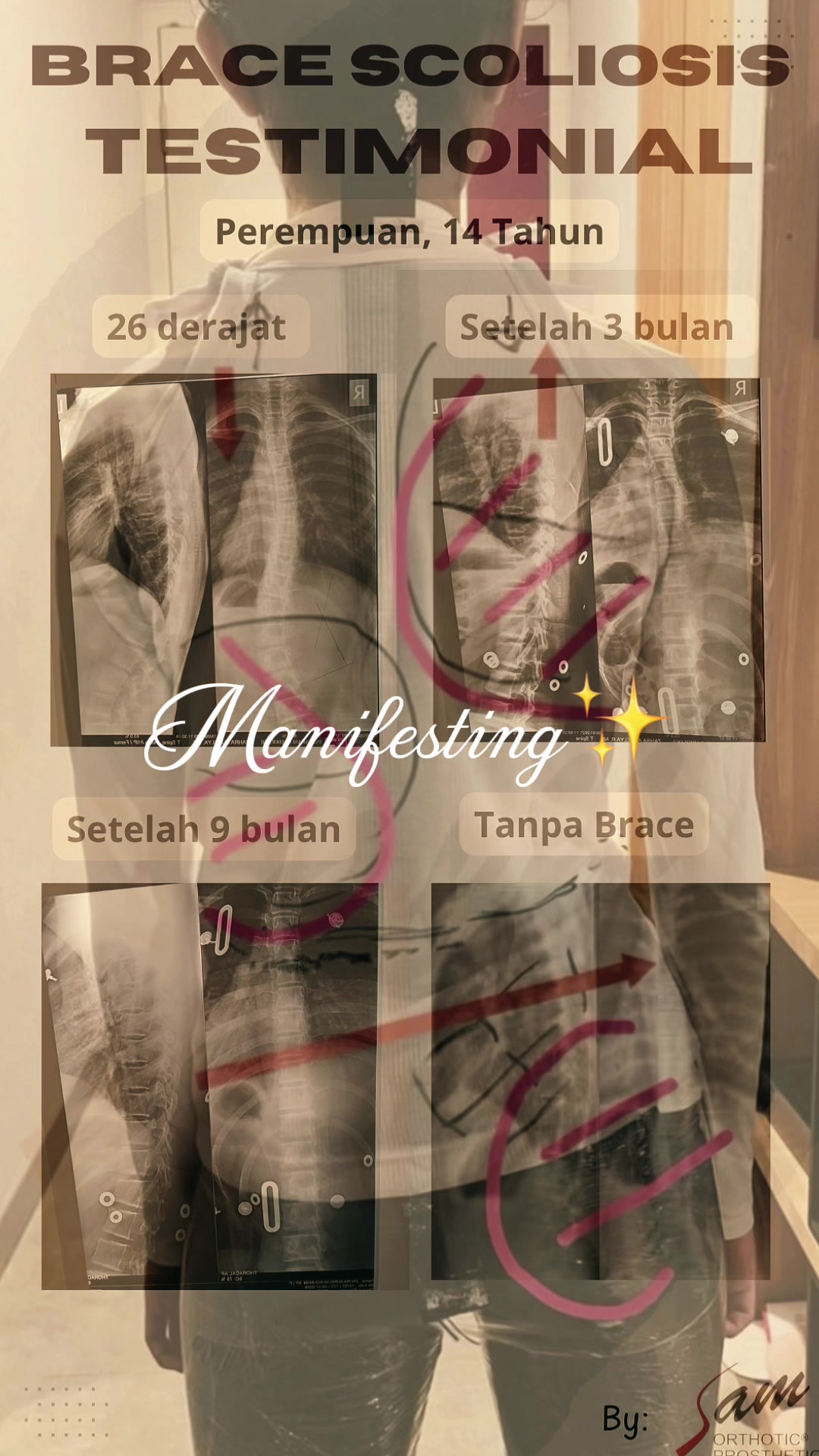 @SAM Orthotic & Prosthetic