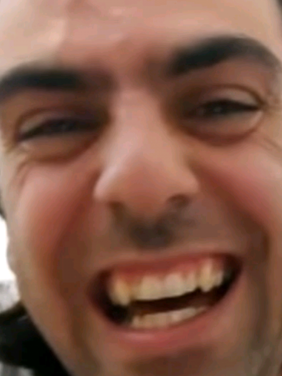@BaldHeadCam