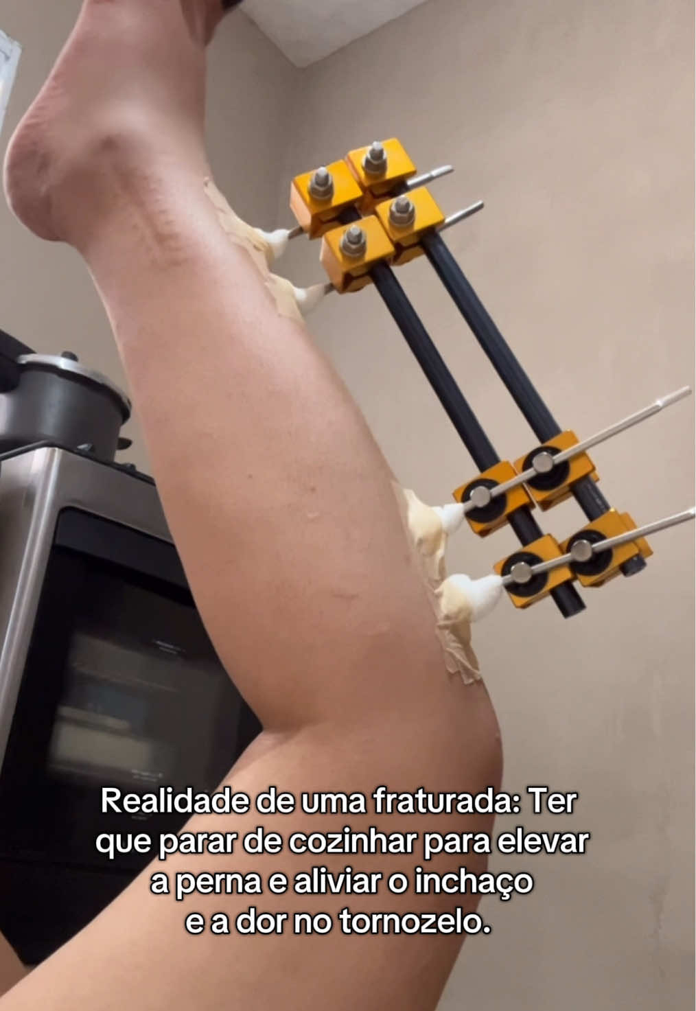 @Ana