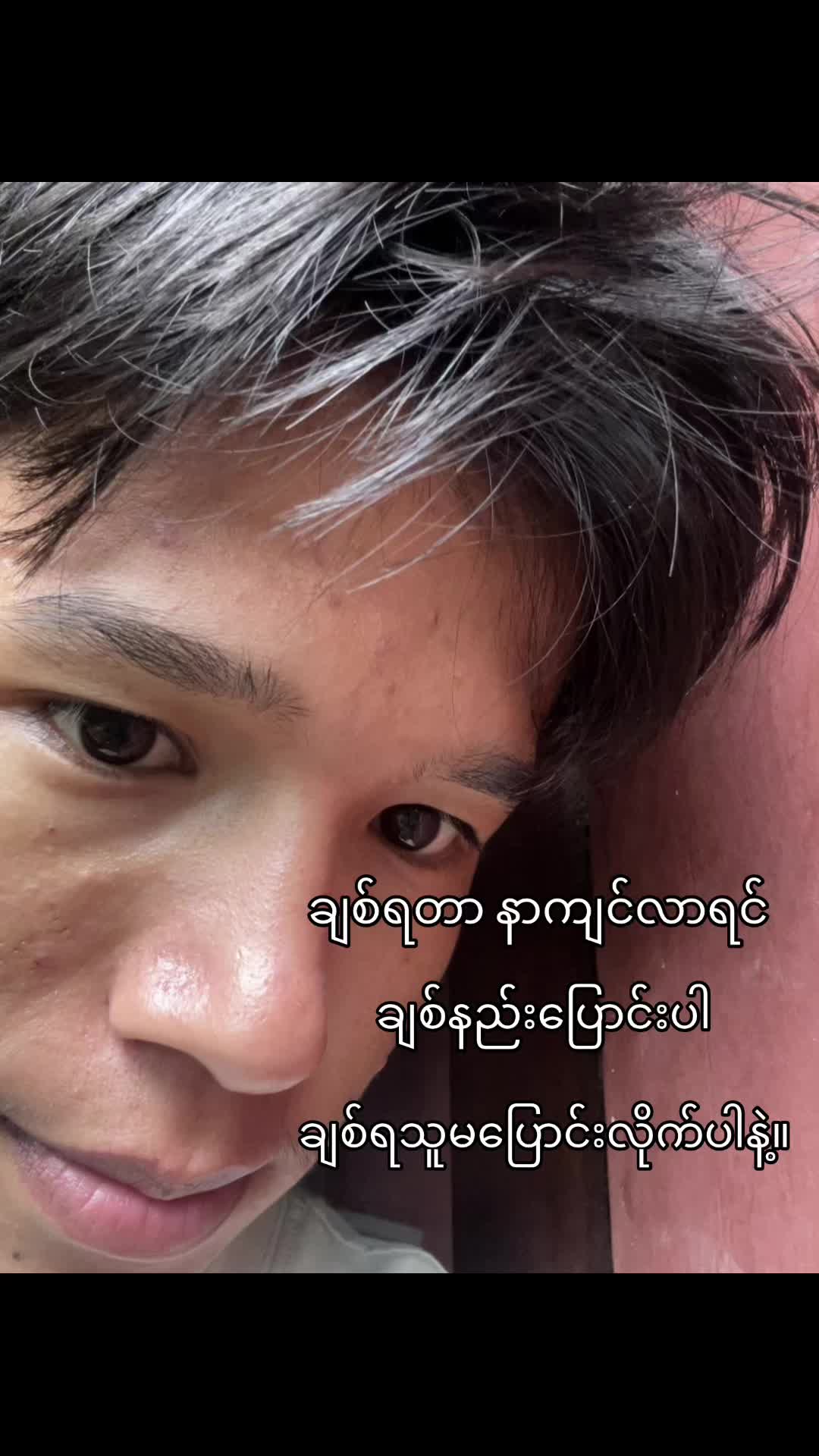 @မောင်ဇွဲ 🥑