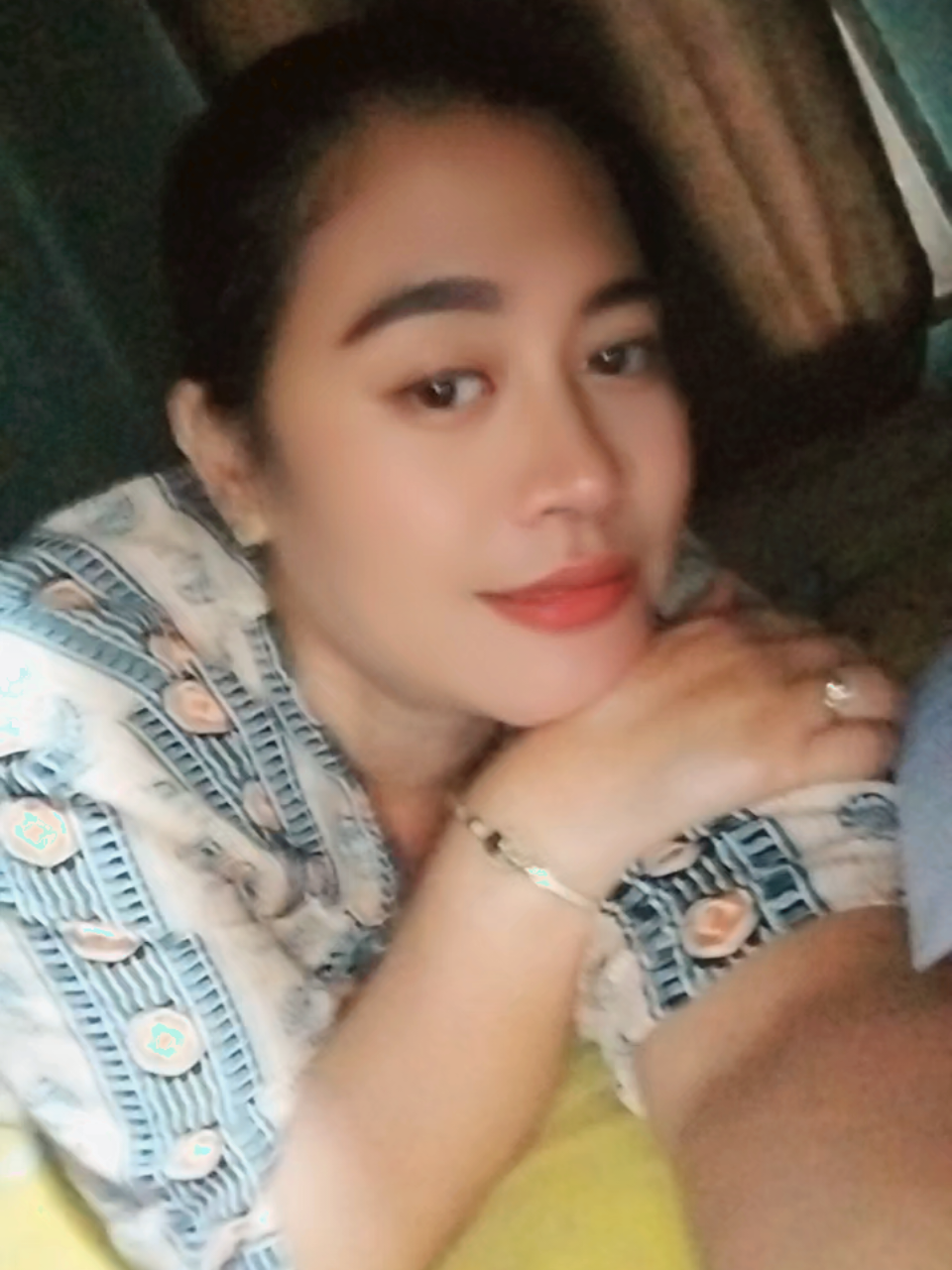 @AMBU BEJO 2025