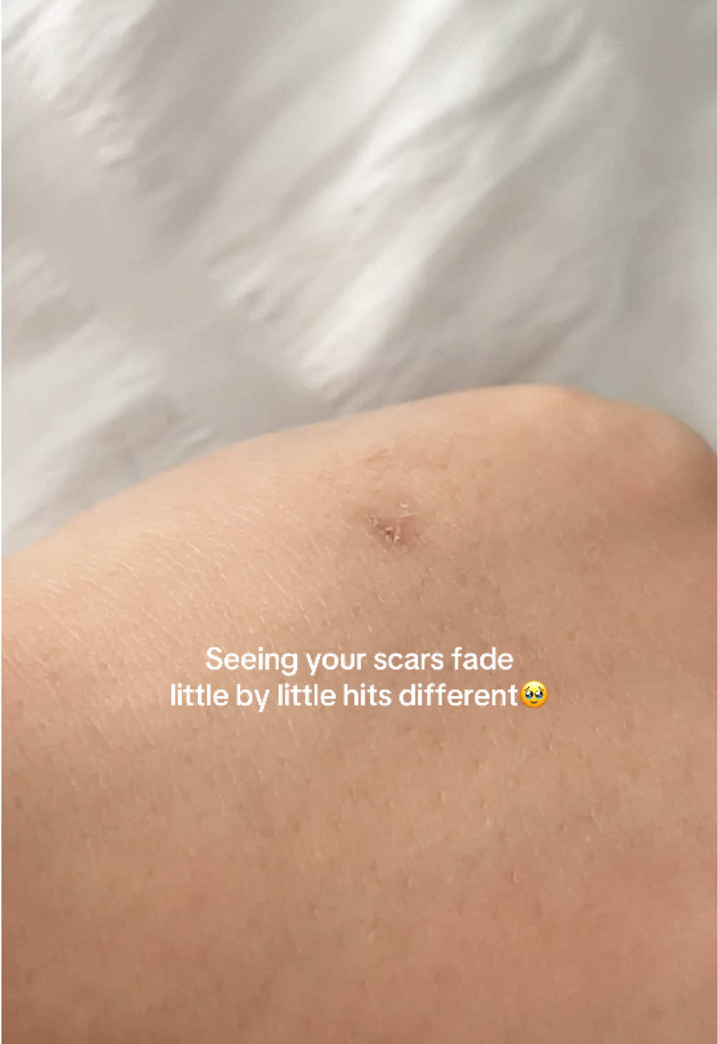 @Radiance Skin Care