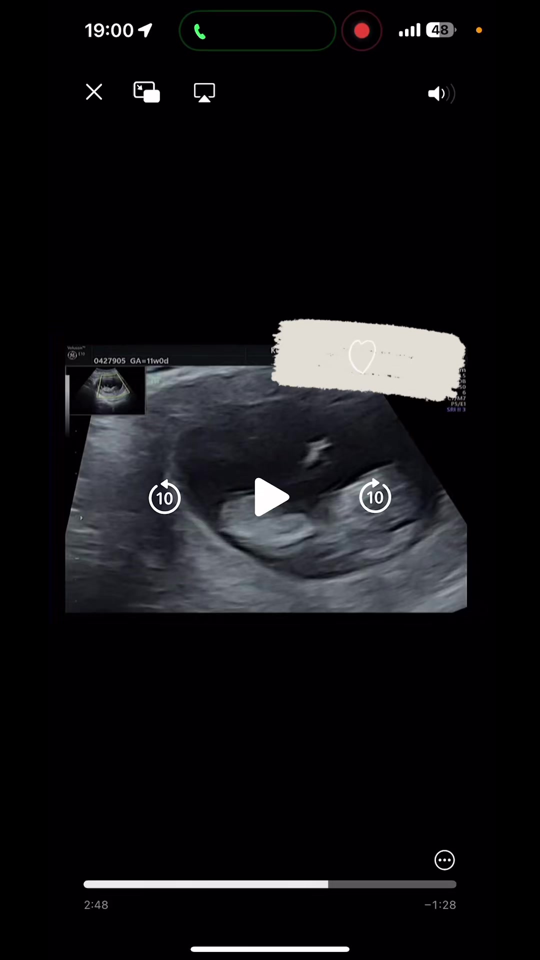@Baby/WAð¶ð»ðŒ