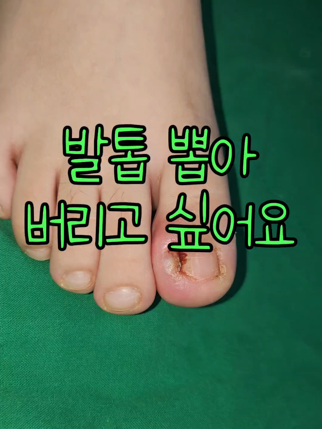 @아문성형외과
