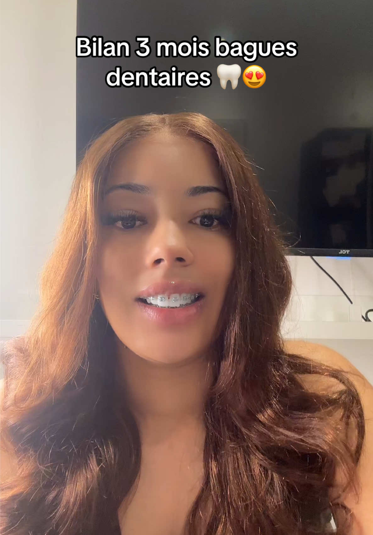 @TheTrophyMethod
