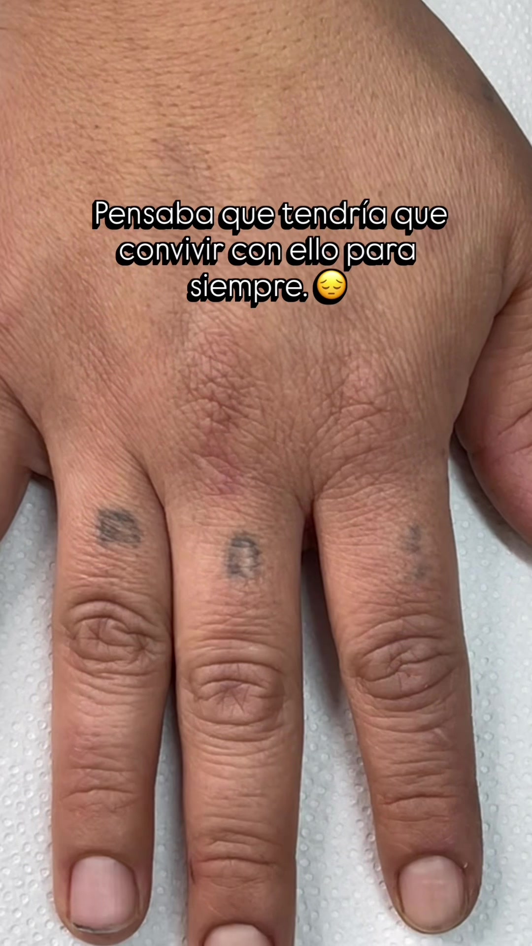 @Reina Reyes