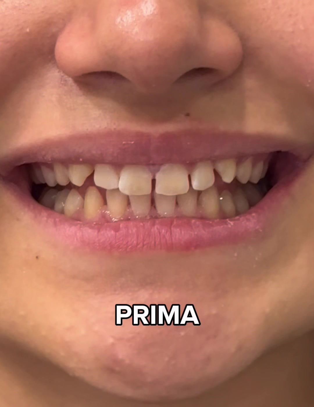 @Dott.Marta | Estetica Dentale