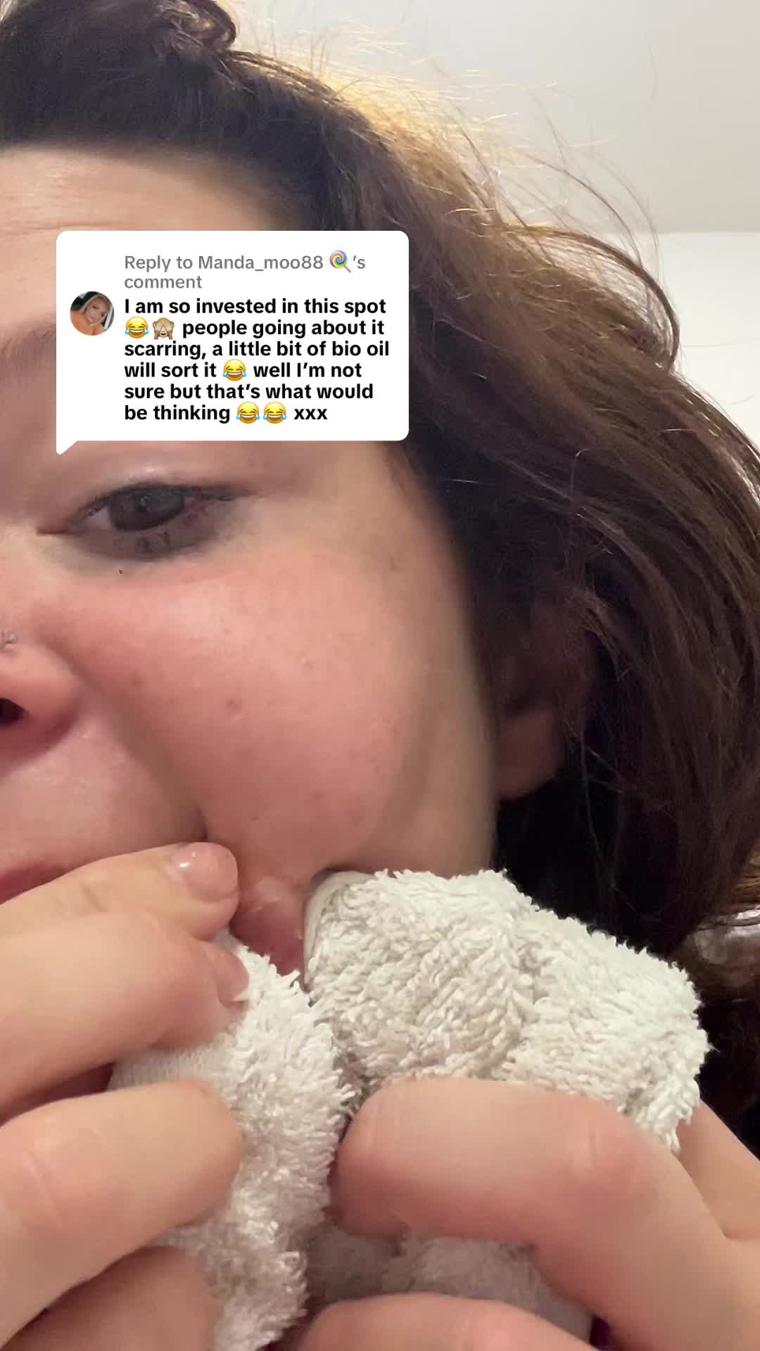 @DyslexicGirl Abbiegale ✨