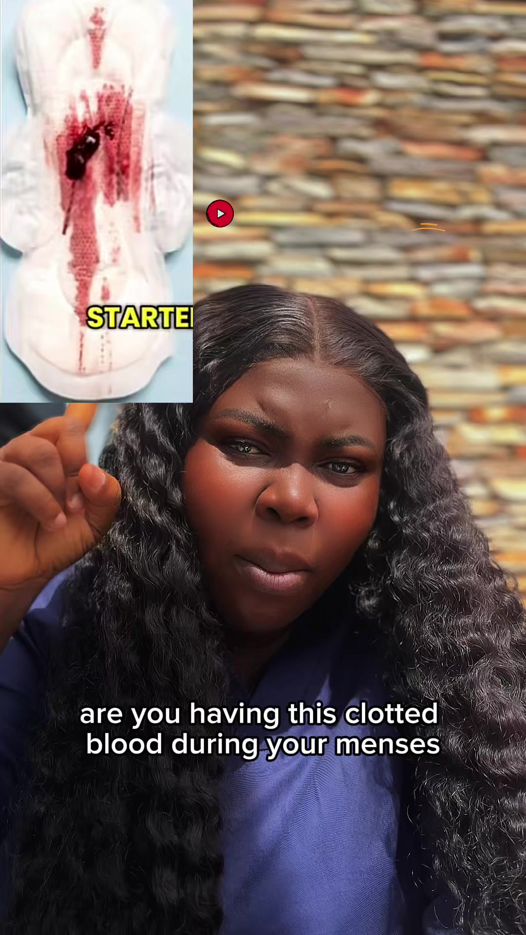 @CelebrityNurseEsther2