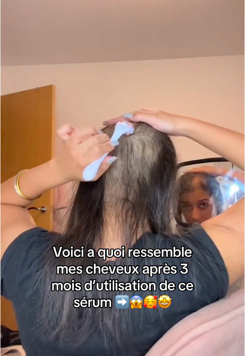 @Lux’Hair Growth FR
