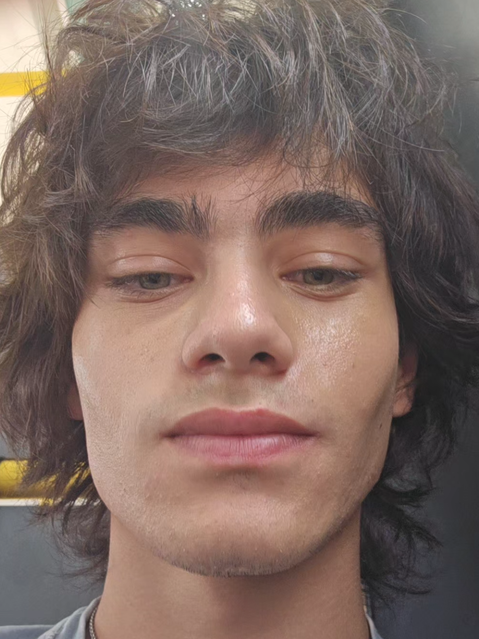 @๐ฉธ๐ง๐ปโ๏ธ๐ท๐๐๐๐ง๐ปโ๏ธ๐ฉธ