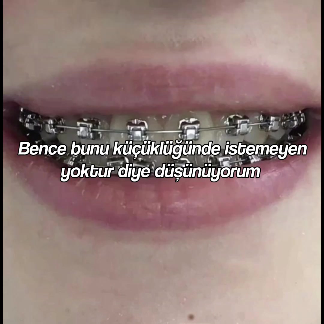 @ᥫᩣ•вяσωиι