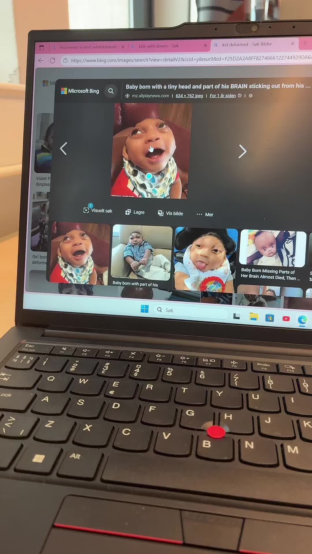 @1TPB