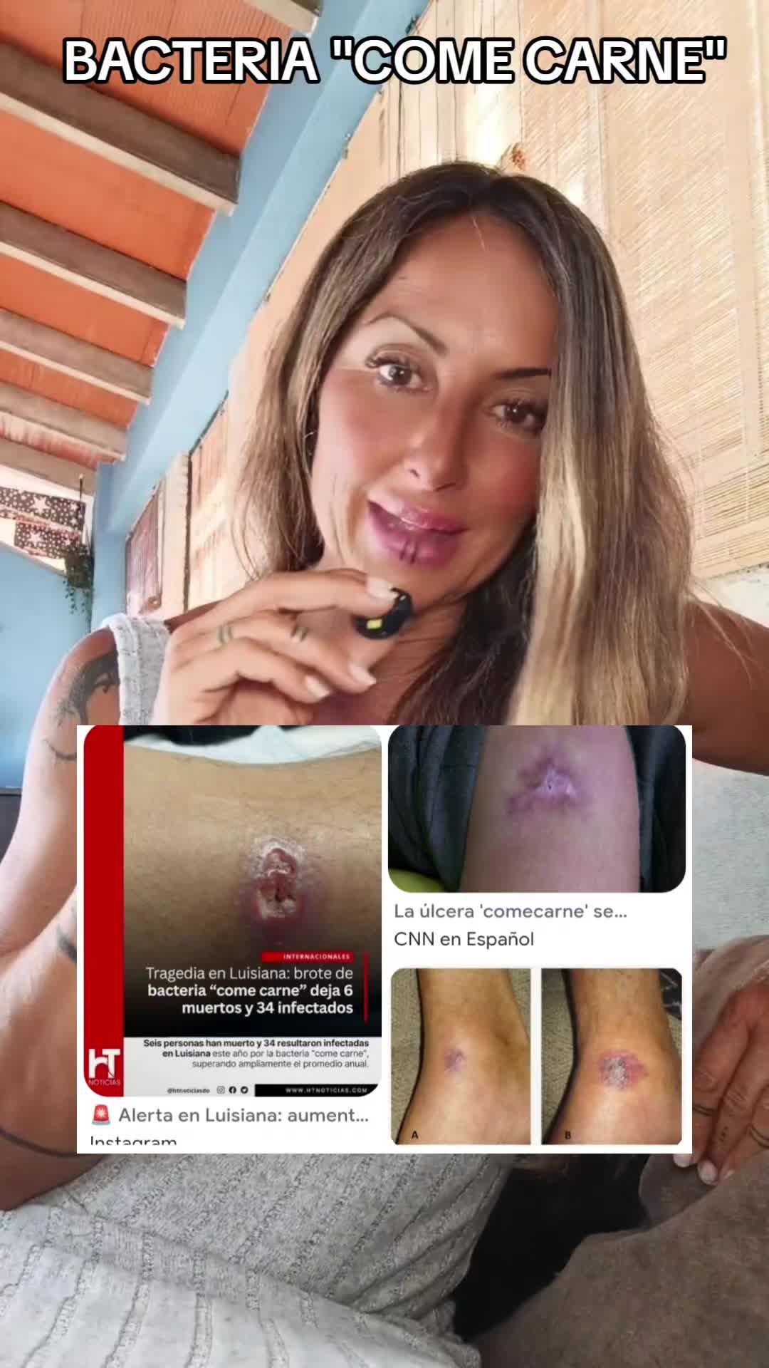 @Ana Fuentes Marin