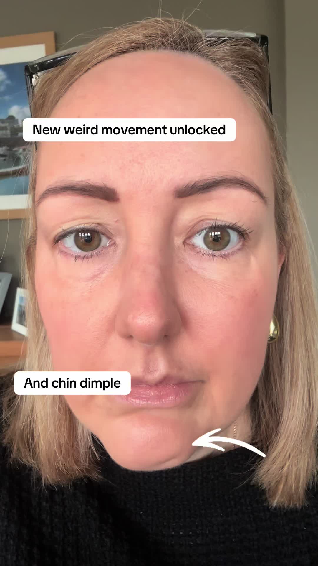 @cholesteatoma.chrissy