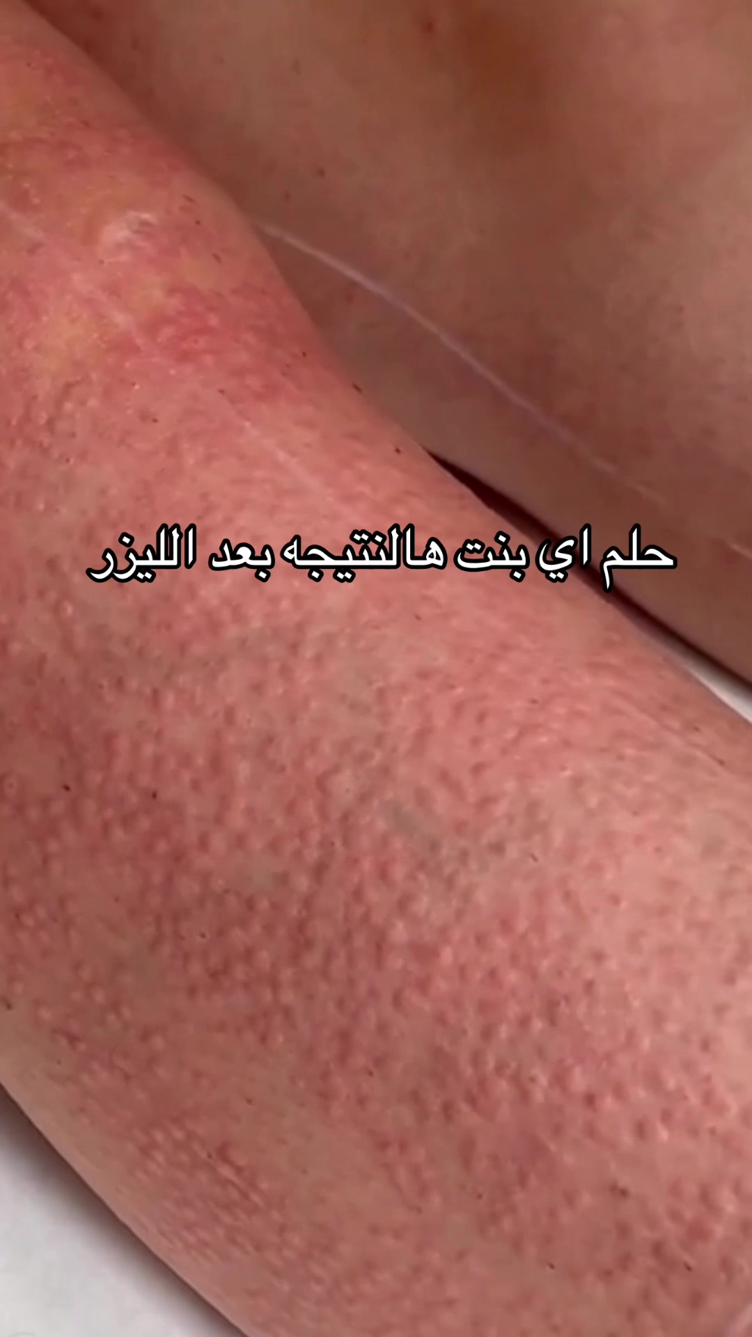 @Diamond clinics|عيادات الماسي