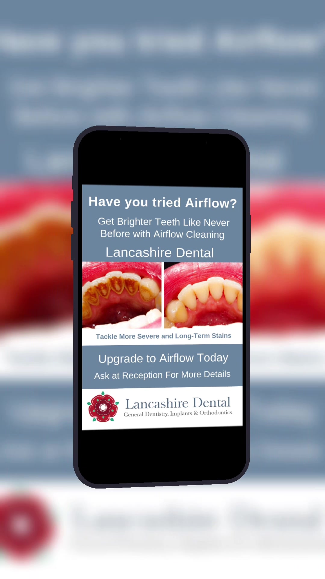 @Lancs Dental