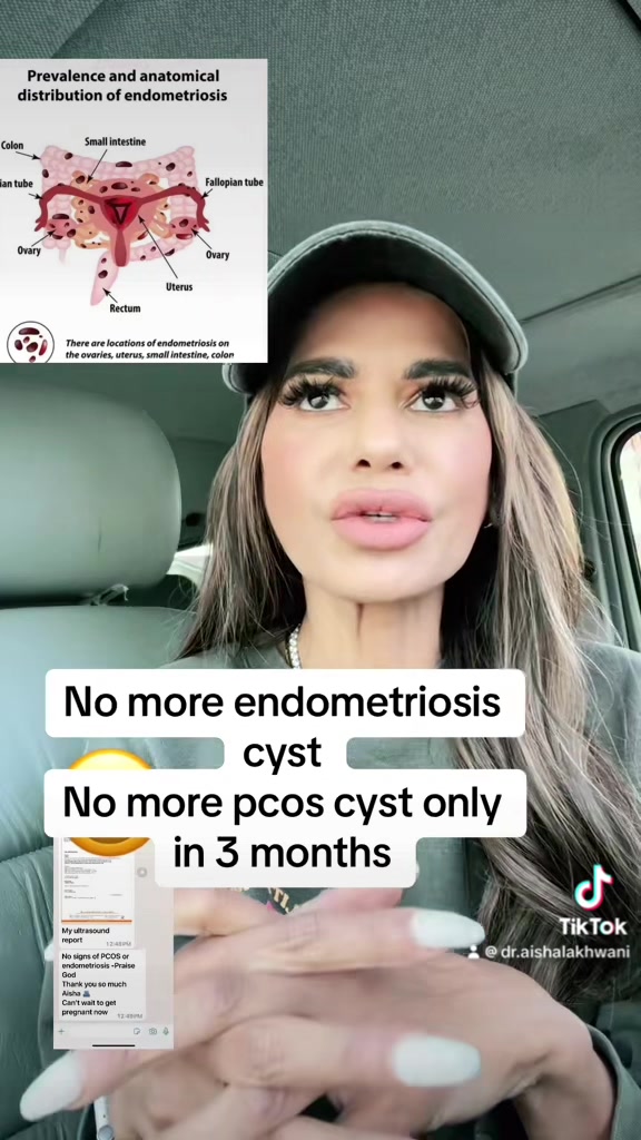 @Dr Aisha Lakhwani fertility