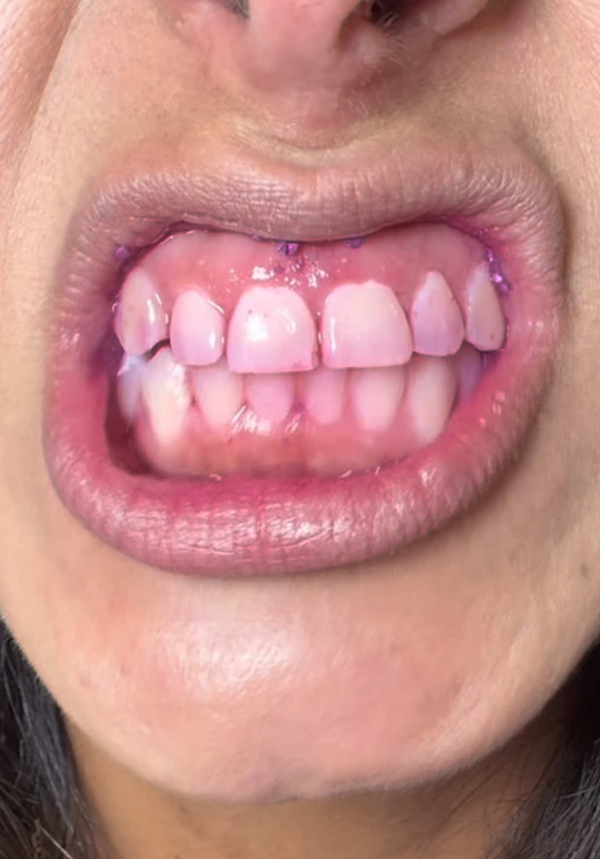 @BySara