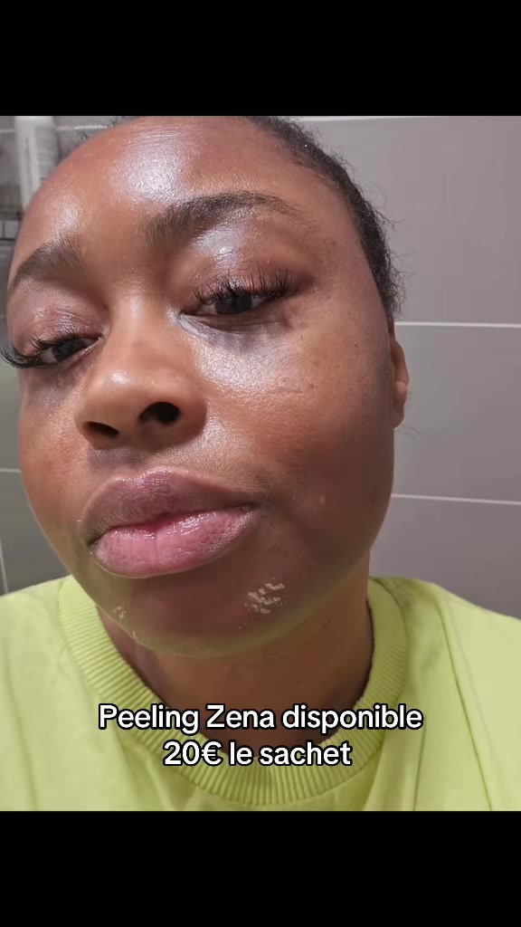 @peeling_zena