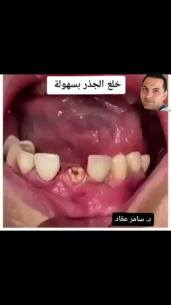 @Samer Akkad | Tandl&auml;kare