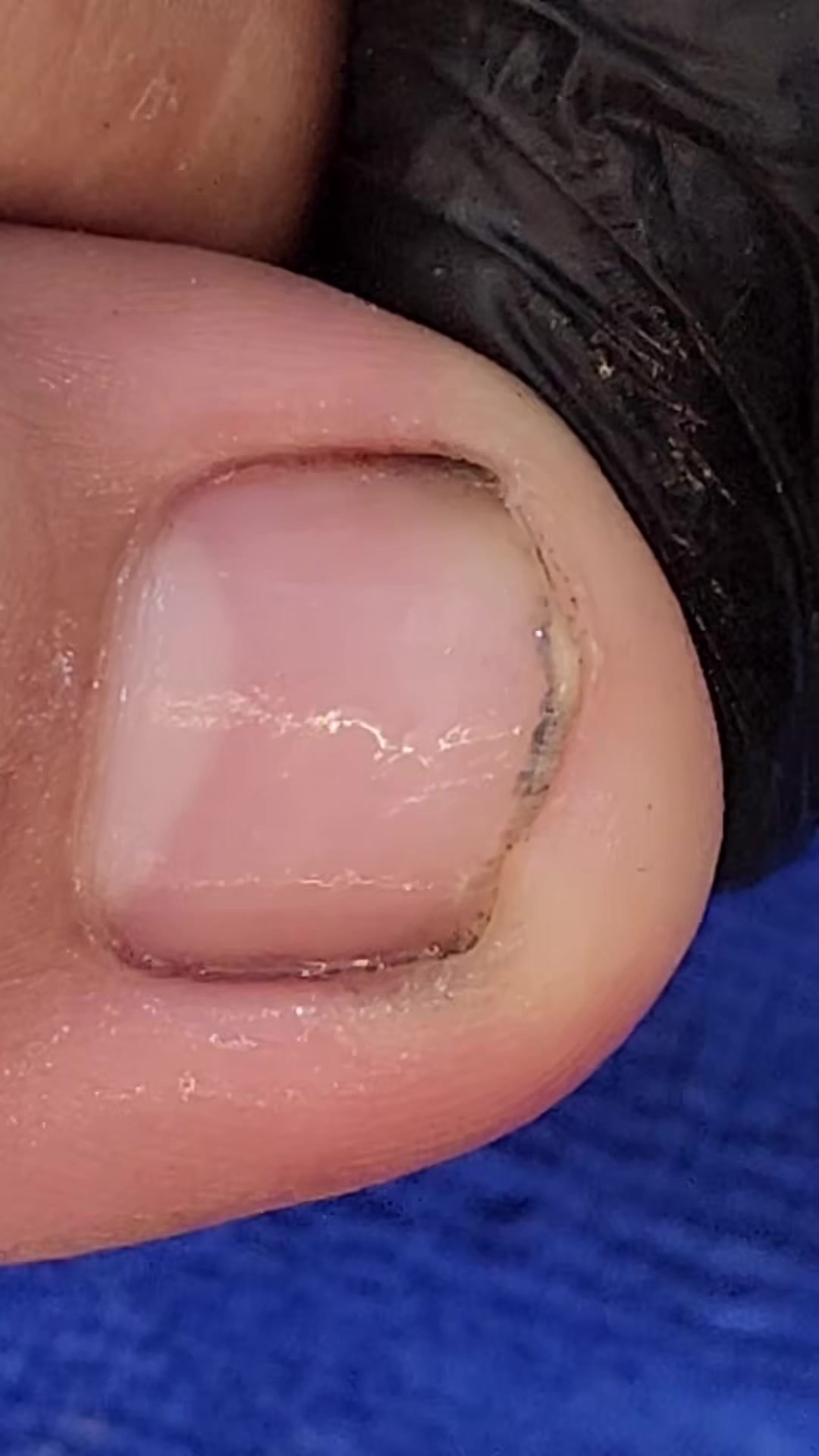 @Toenails.clips
