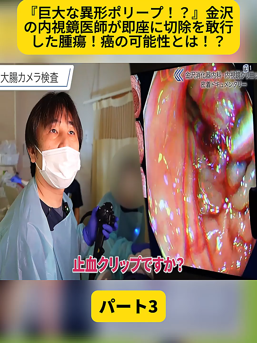 @金沢内視鏡医 医療密着ドキュメンタリー