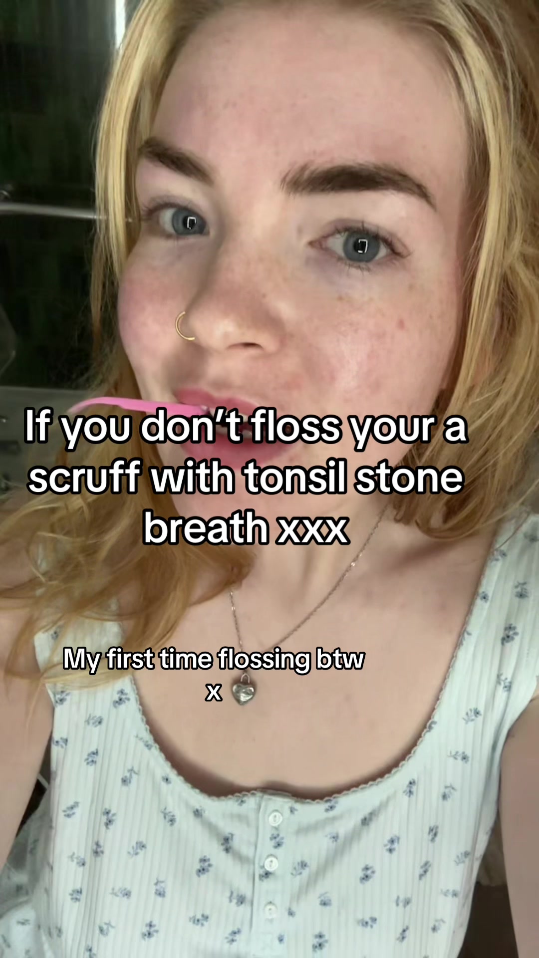 @Kirsty Gallagher