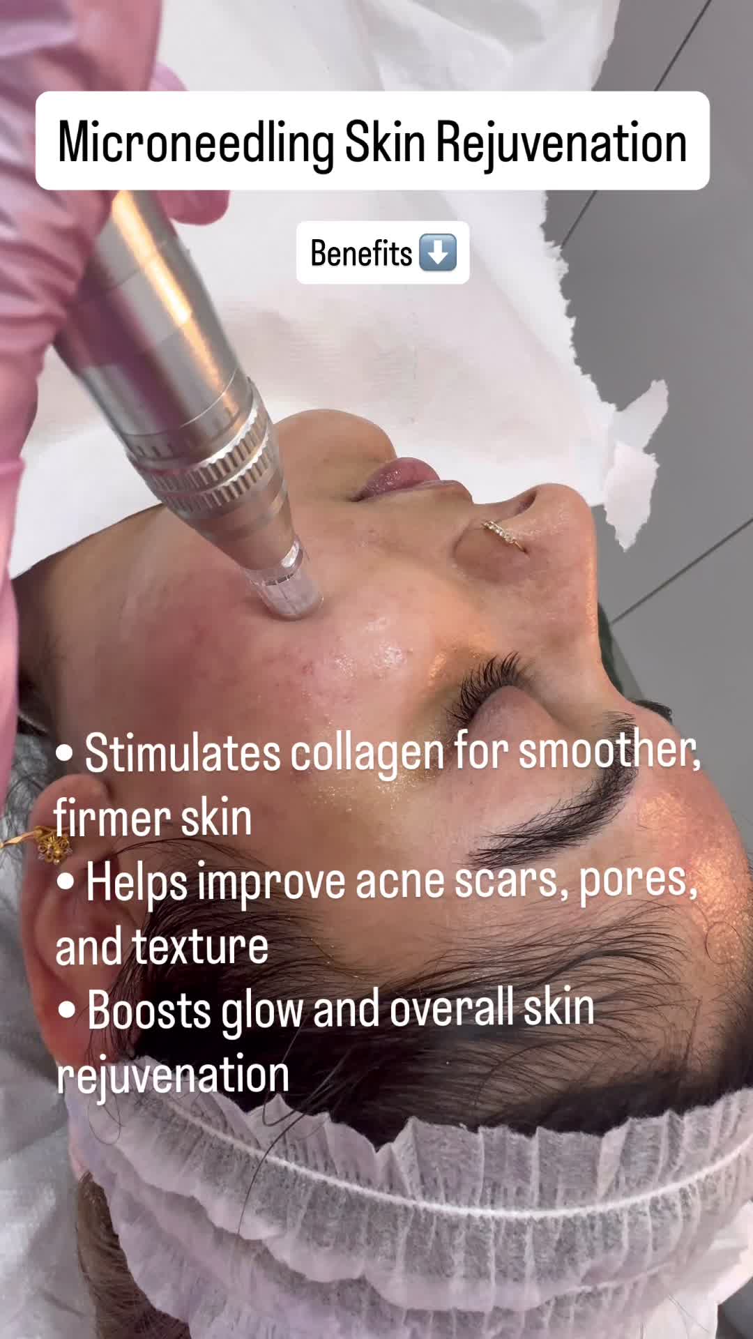 @The Facebysk