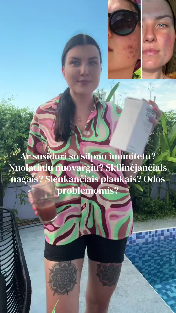 @agnuela
