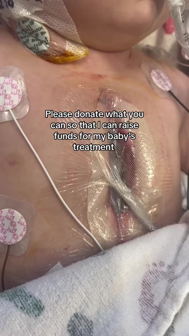 @Save  Burger 💔🥺