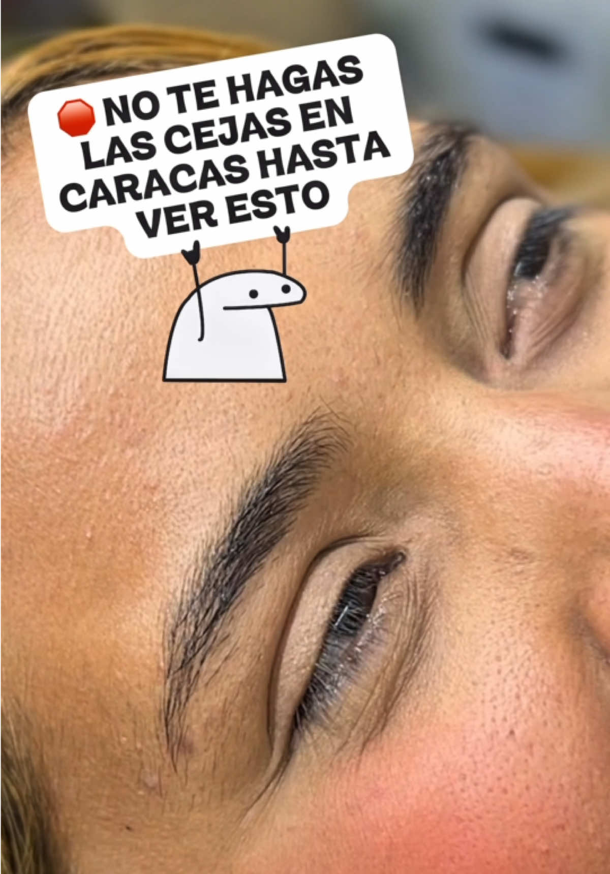 @Jhonny Cejas