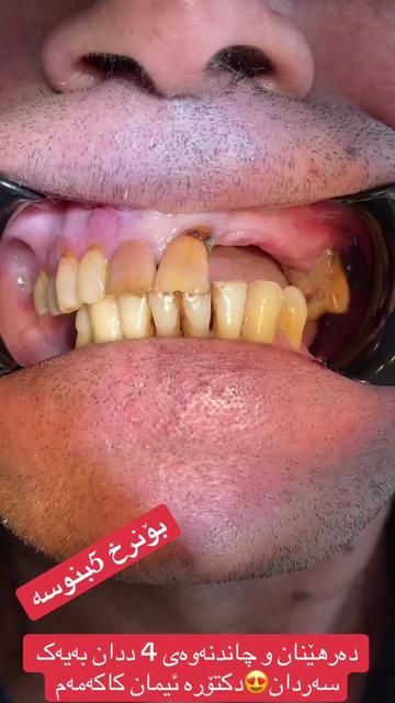 @🦷 دکتۆرە ئیمان کاکەمەم