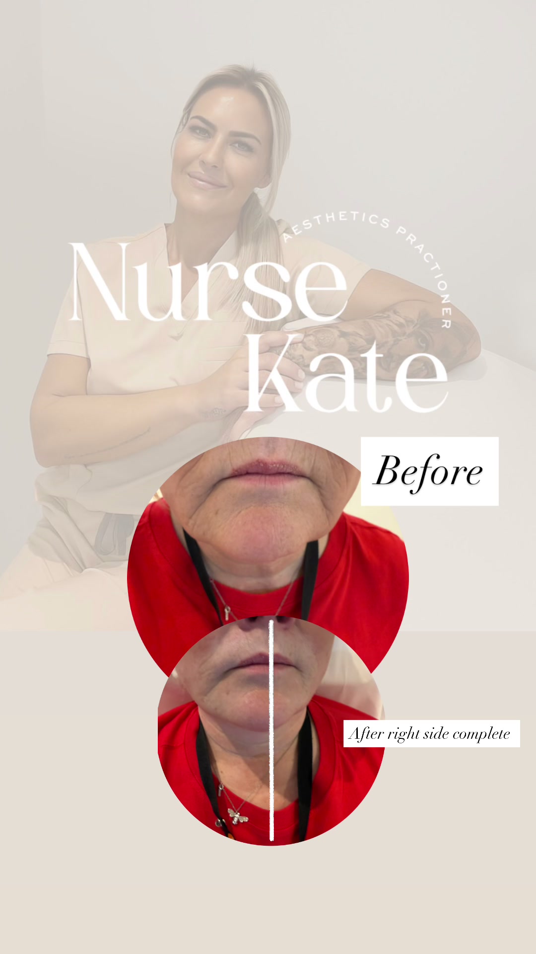 @Nurse Kate Aesthetics
