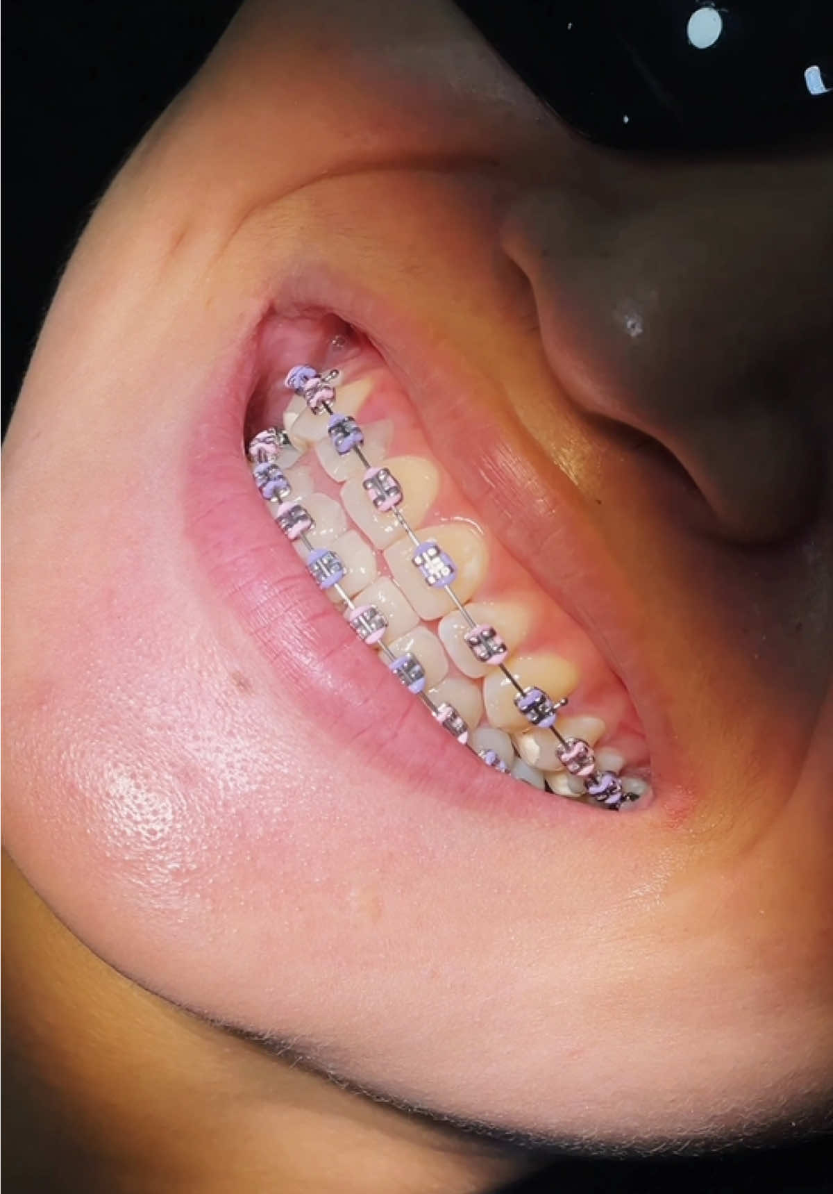@BRIGHT SMILE DENTAL HOSPITAL