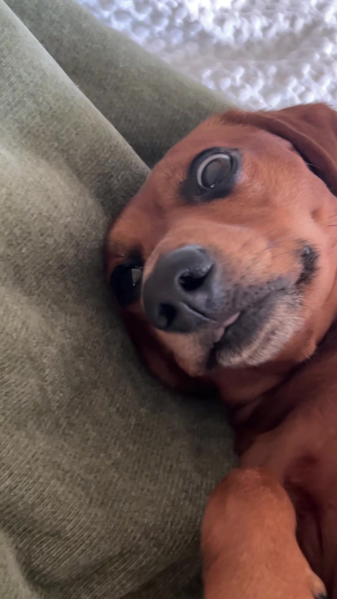 @Slinky Severus-Doo