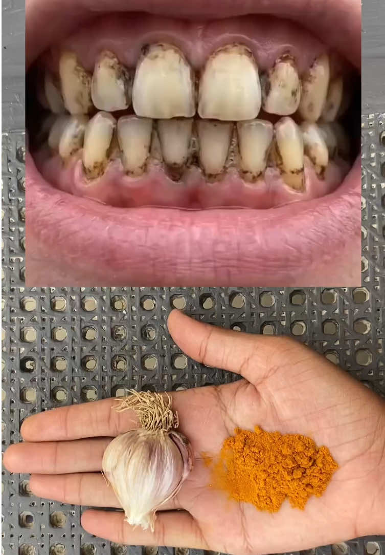 @RemdyGuru35