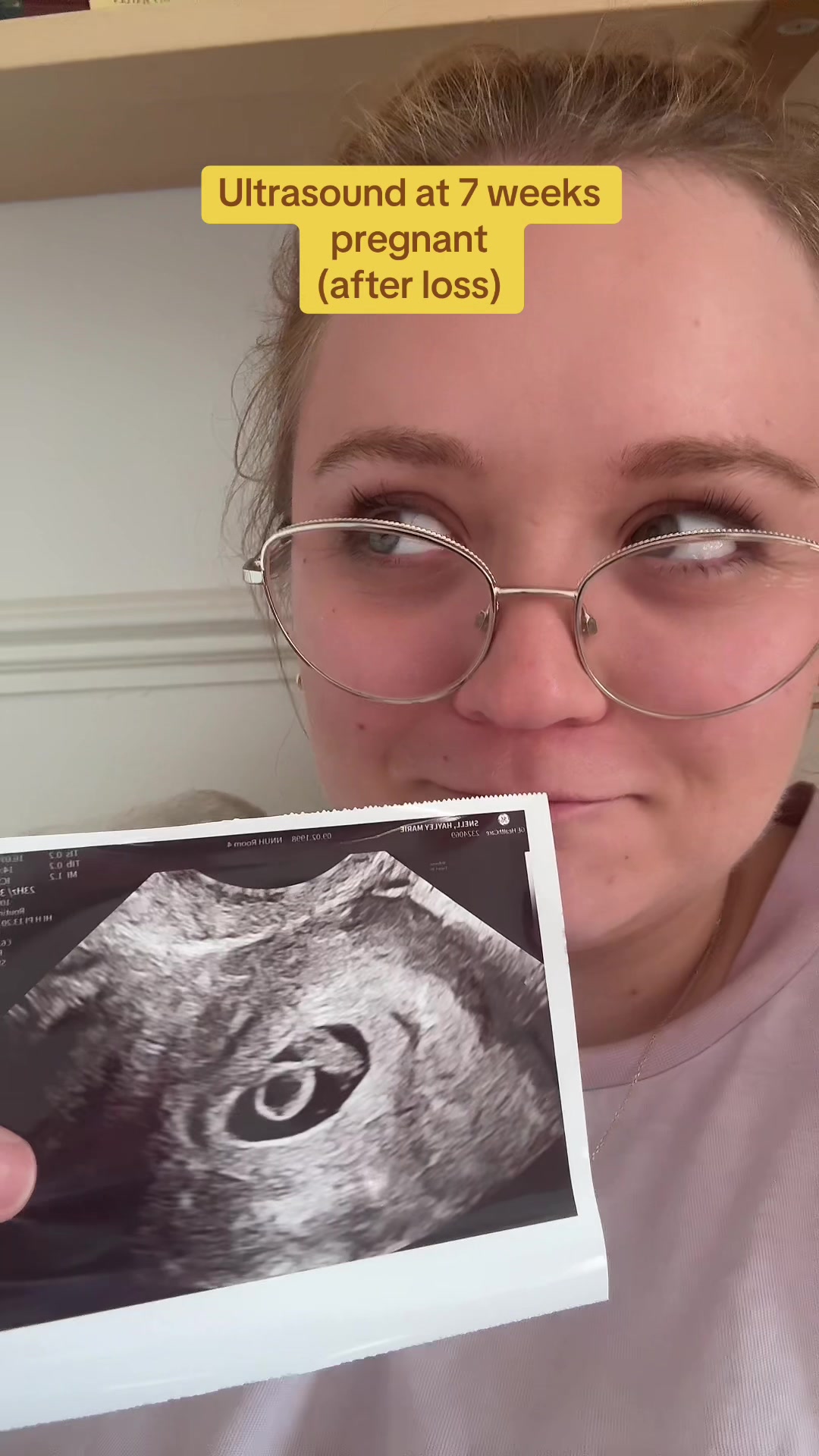 @H | pregnancy after loss 💛