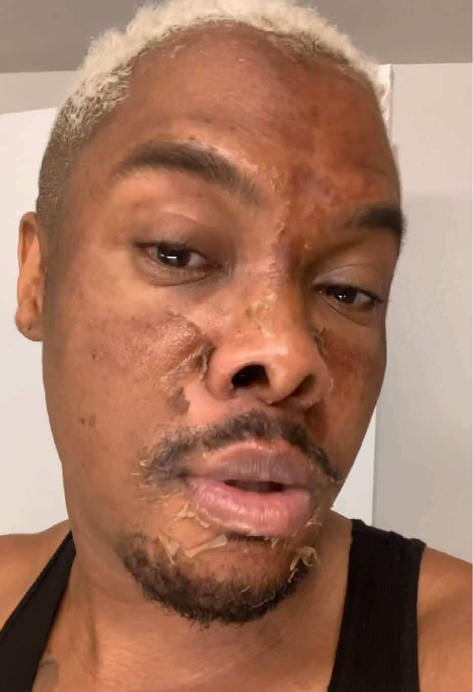 @Ronnie