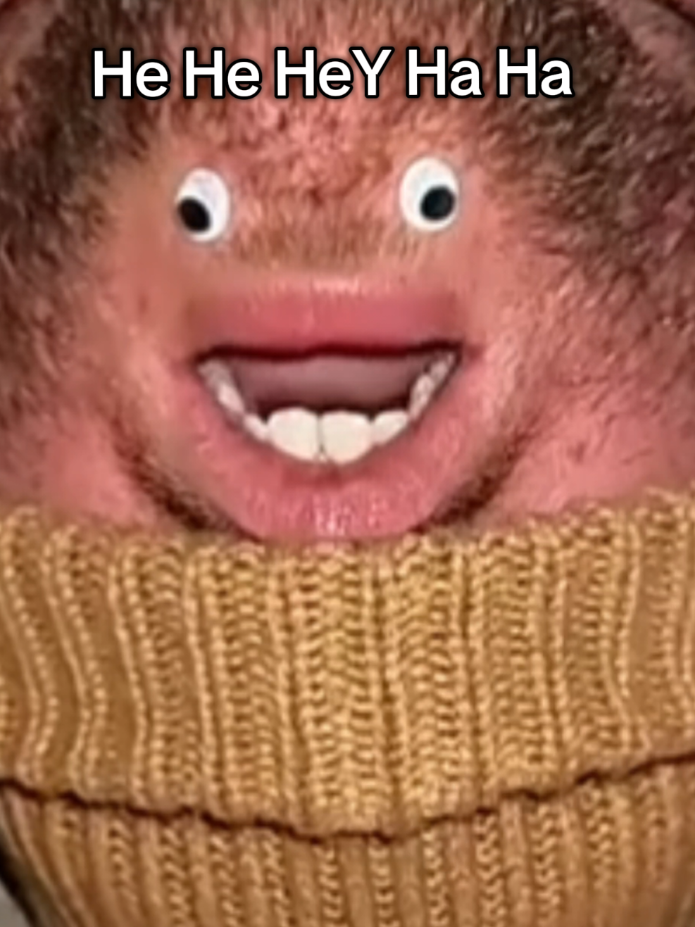 @Chinfaced