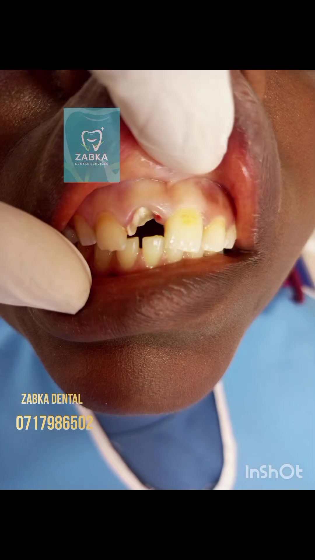 @Zabka Dental