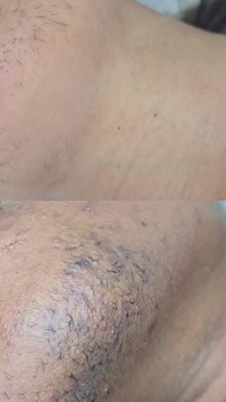 @Nadine Electrolysis.Waxing
