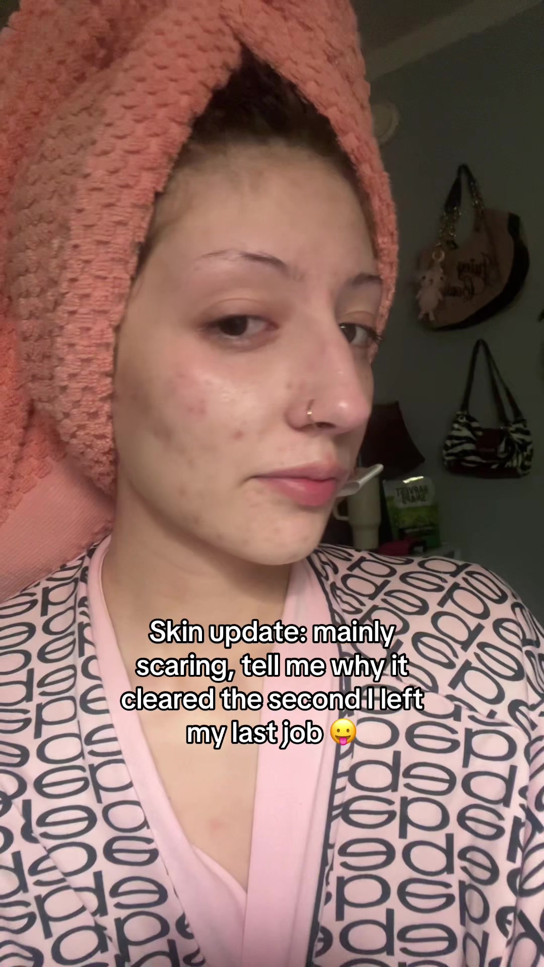 @:)