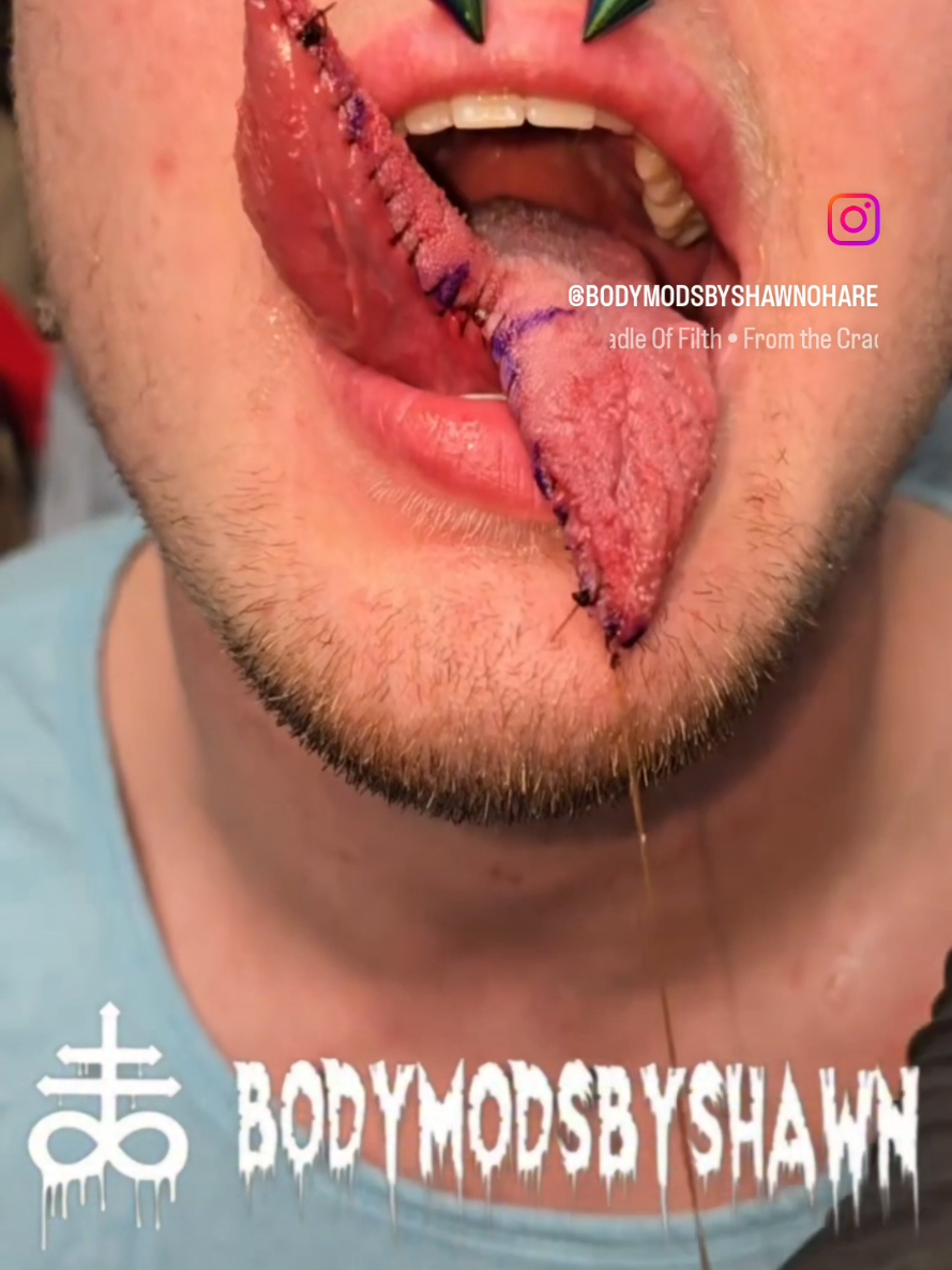 @BodymodsbyShawn