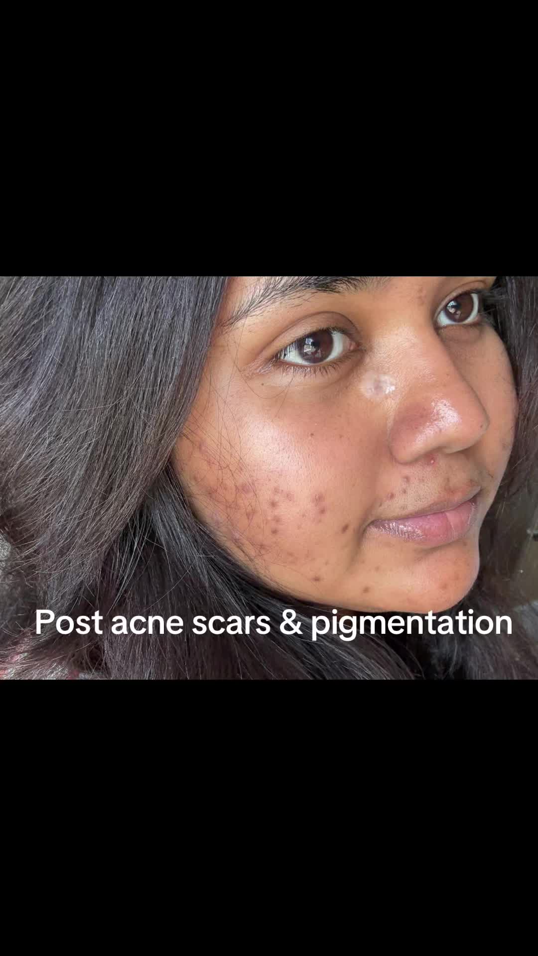 @Sreellsss
