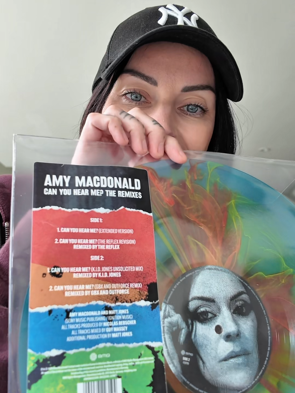 @Amy Macdonald