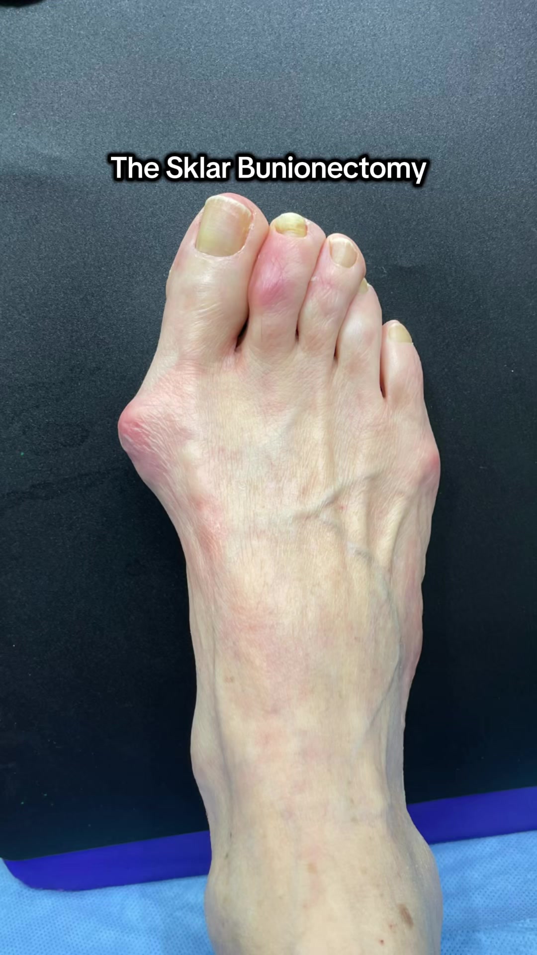@Foot First Podiatry