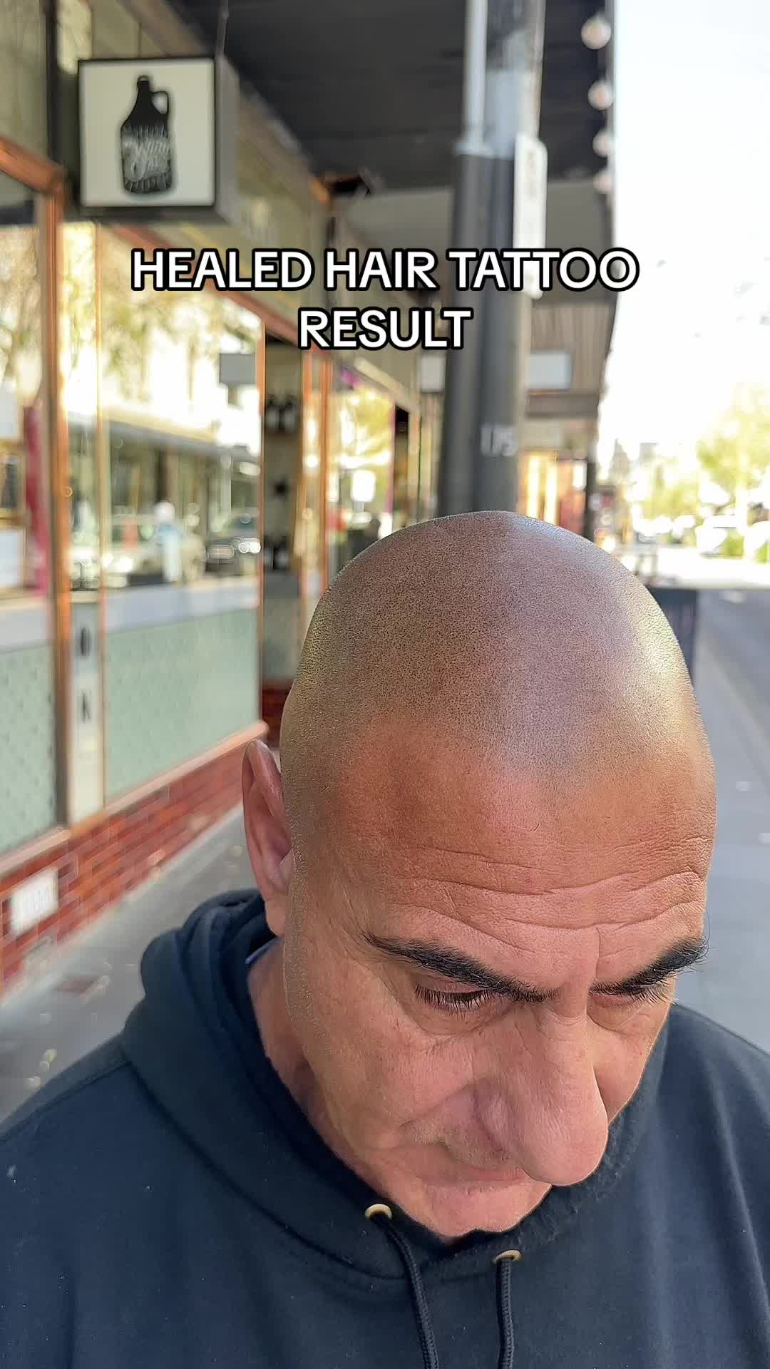 @naturalprosmp