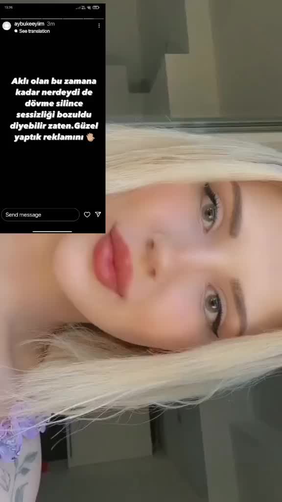 @AHMET 35